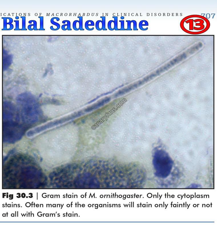 صورة